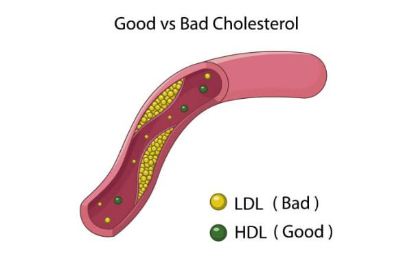 HDL là cholesterol tốt cho cơ thể.