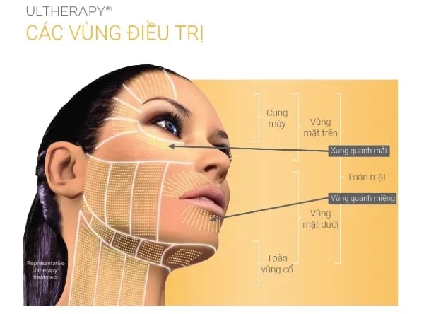 Ultherapy là một trong những công nghệ nâng cơ mặt, trẻ hóa da hàng đầu trên thế giới.