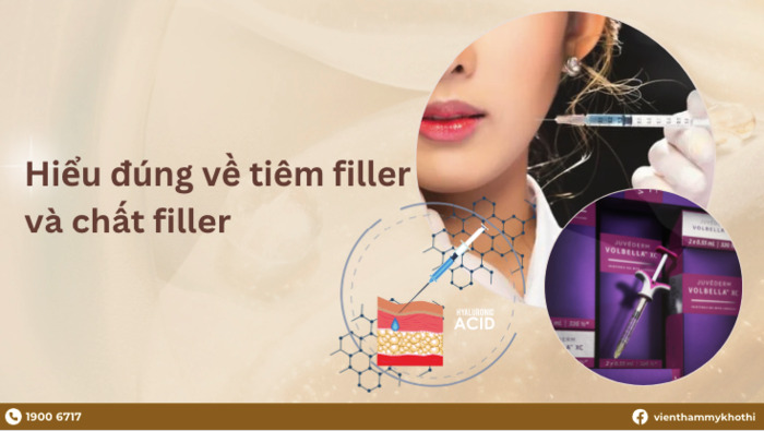 Filler có chứa HA là loại được dùng phổ biến nhất, có tác dụng làm đầy các nếp nhăn không mong muốn trên gương mặt